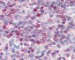 Leukotriene B4 Receptor / BLT1 Antibody (Cytoplasmic Domain)